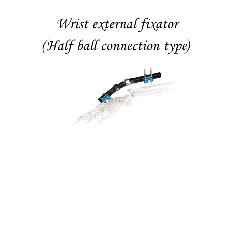 Single-Sided Integrated Wrist External Fixator (Half ball connection type)